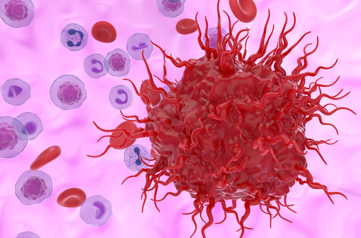 Breakthrough therapy improves outcomes for patients with neuroendocrine tumours