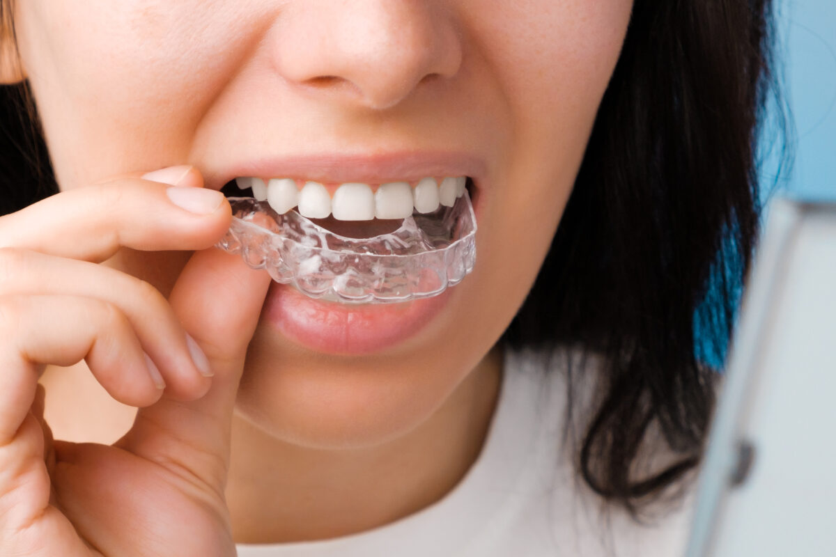 Invisible and traditional adult braces both effectively straighten teeth differently