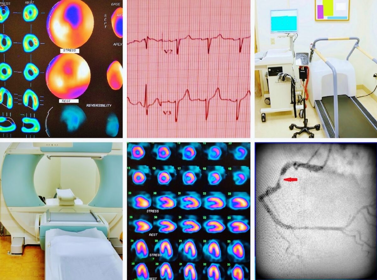 Myocardial perfusion imaging remains a cornerstone for accurate cardiac diagnostics