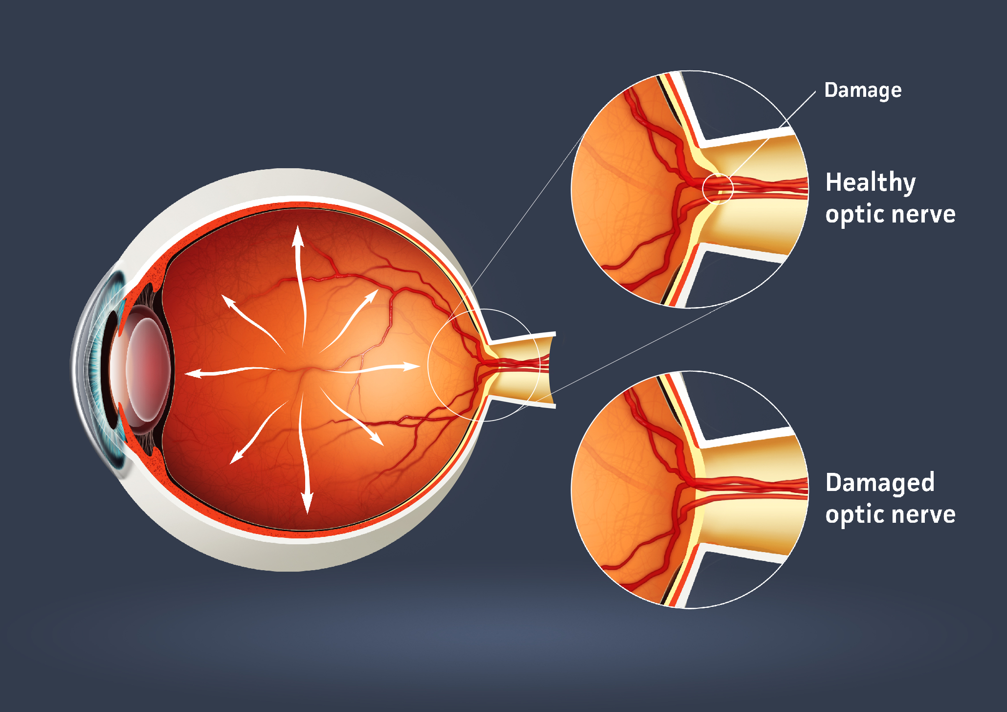 This guide outlines imaging from symptoms to retinal detachment surgery