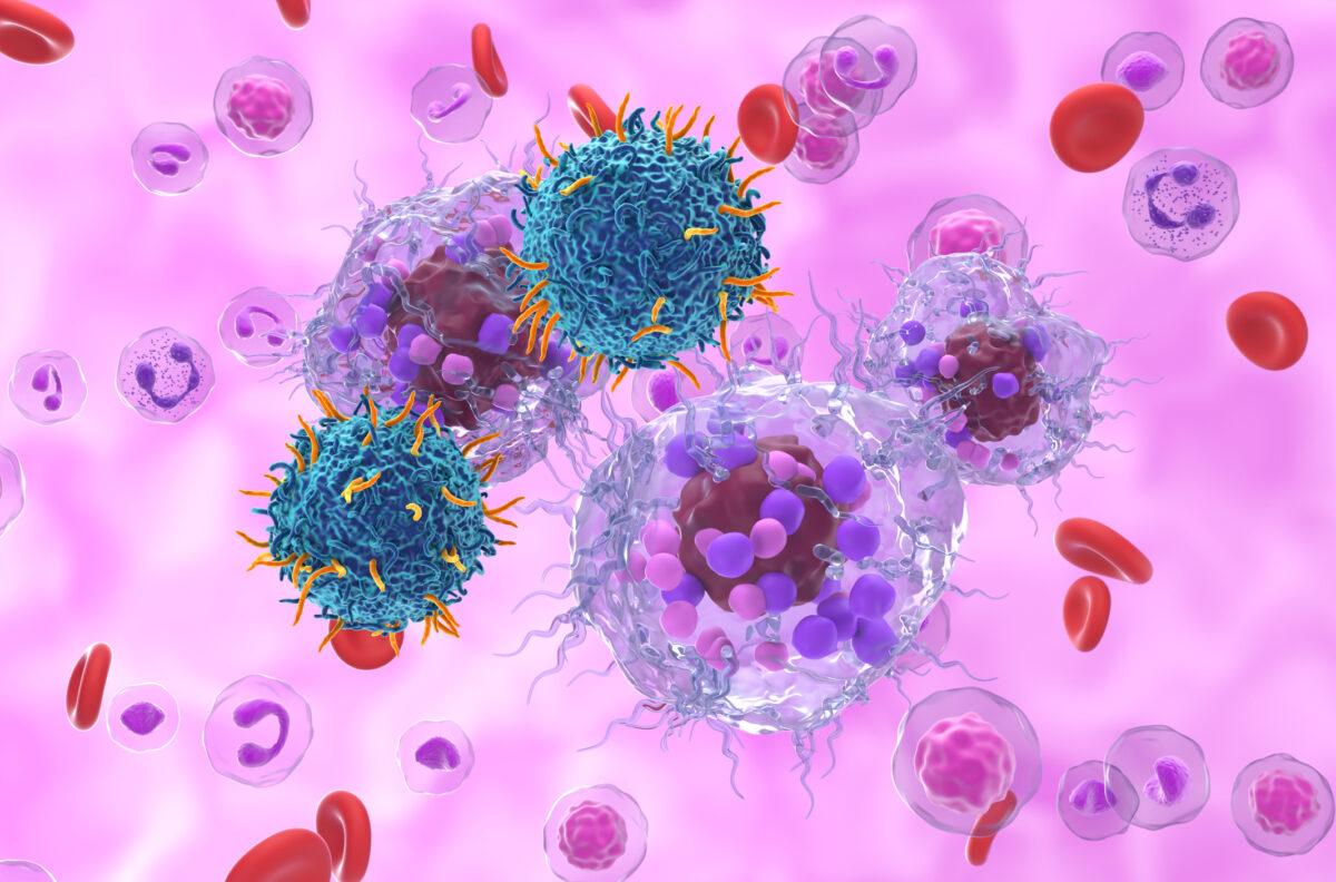 New therapies improve outcomes in treatment of neuroendocrine neoplasms today