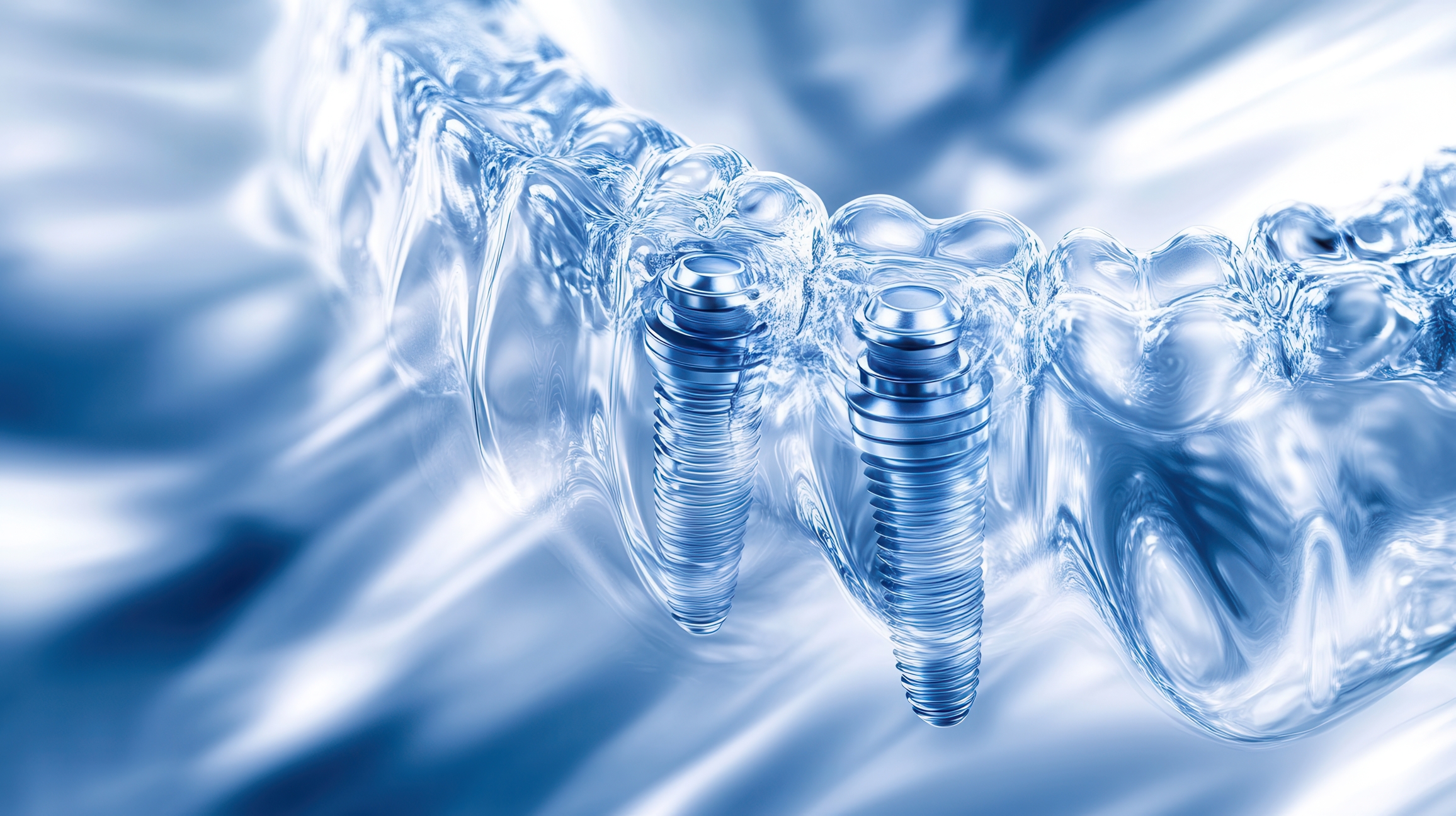 Biomaterials in dental implantology support bone healing and long-term stability