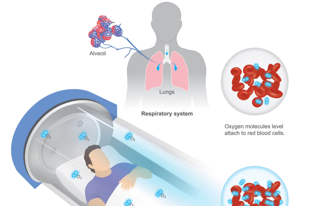 Hyperbaric oxygen therapy promotes healing by increasing oxygen delivery significantly