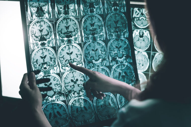 Neurodiagnostics interoperability connects radiology and neurology for faster clinical decisions