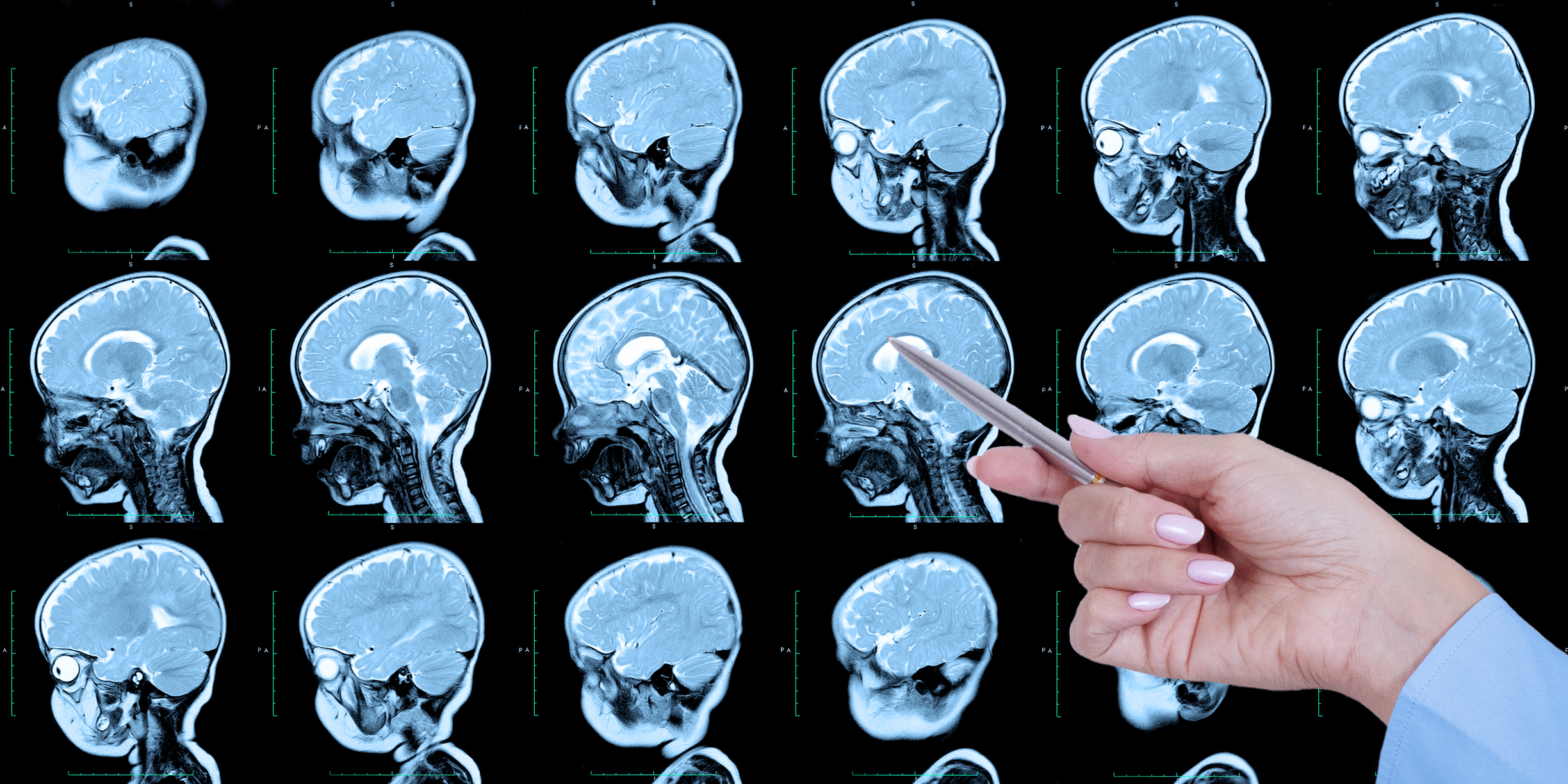 Optimizing diagnostic accuracy improves cancer detection, treatment decisions, and patient outcomes