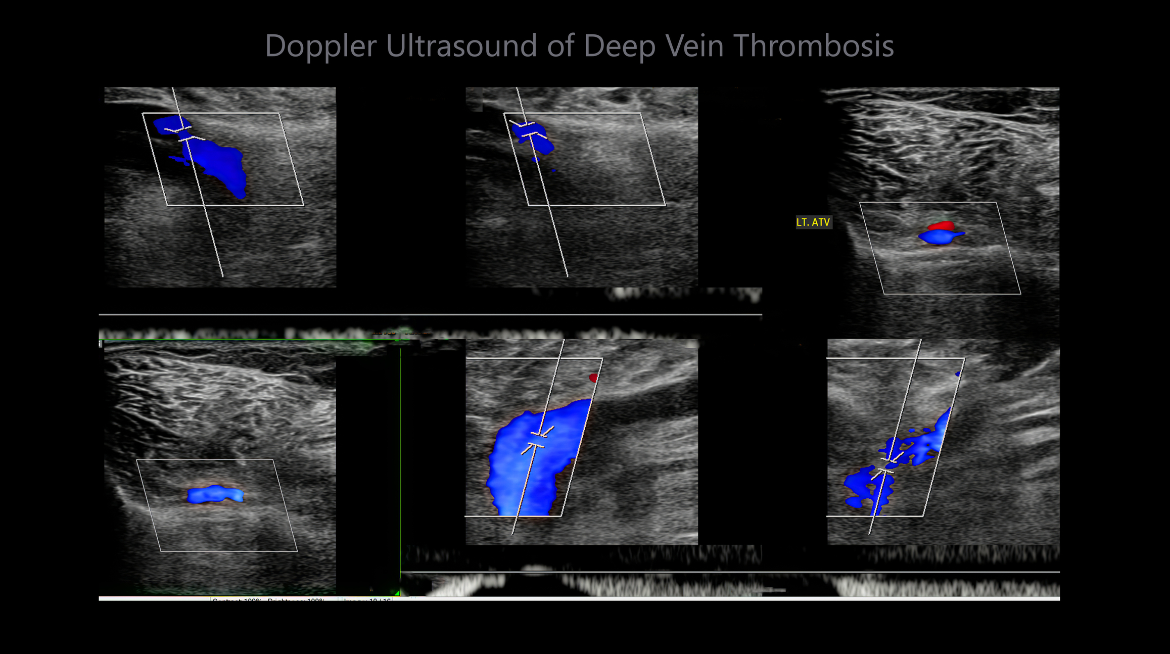 Modern vein treatments improve circulation, comfort, recovery, and patient outcomes