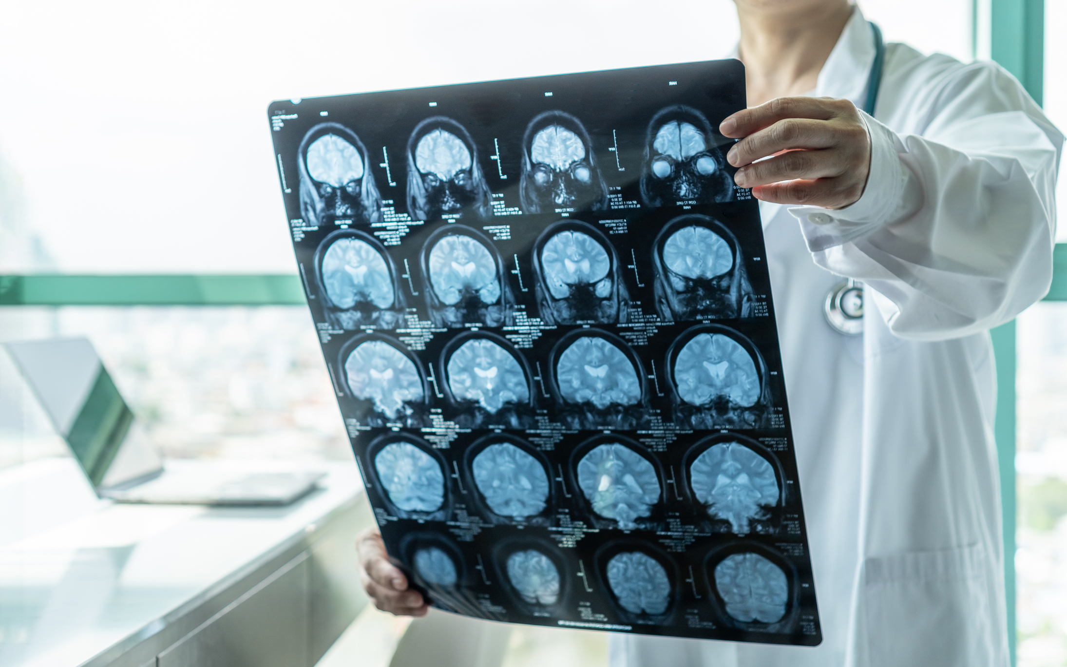 Medical imaging is changing the fight against chronic illness worldwide