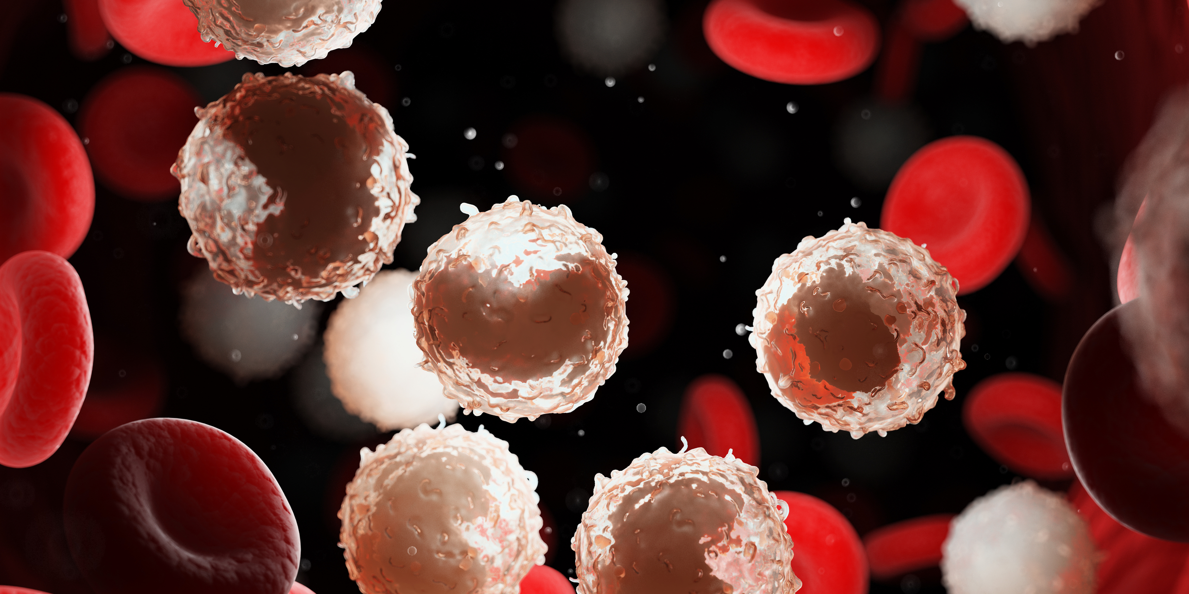 Treatment begins when chronic leukaemia progresses or significant symptoms develop